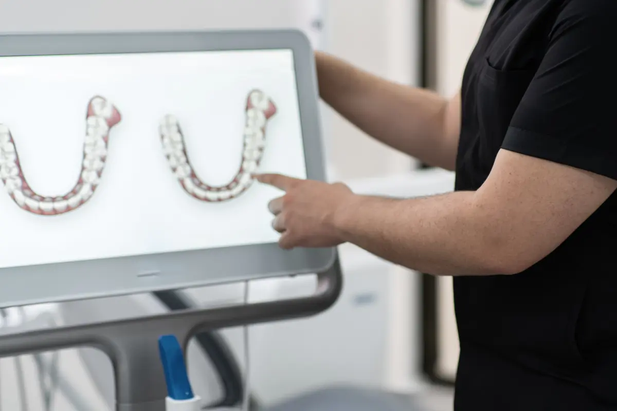 Aparat bezligaturowy – czym jest, działanie oraz cena apartu na zęby