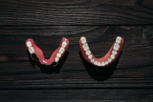 Kiedy warto robić zęby metodą All on 4